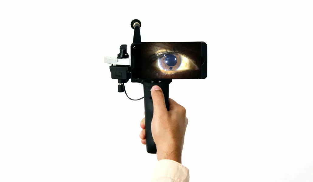 Portable Digital Slit Lamp