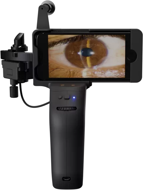 Portable Digital Slit Lamp for wherever care happens