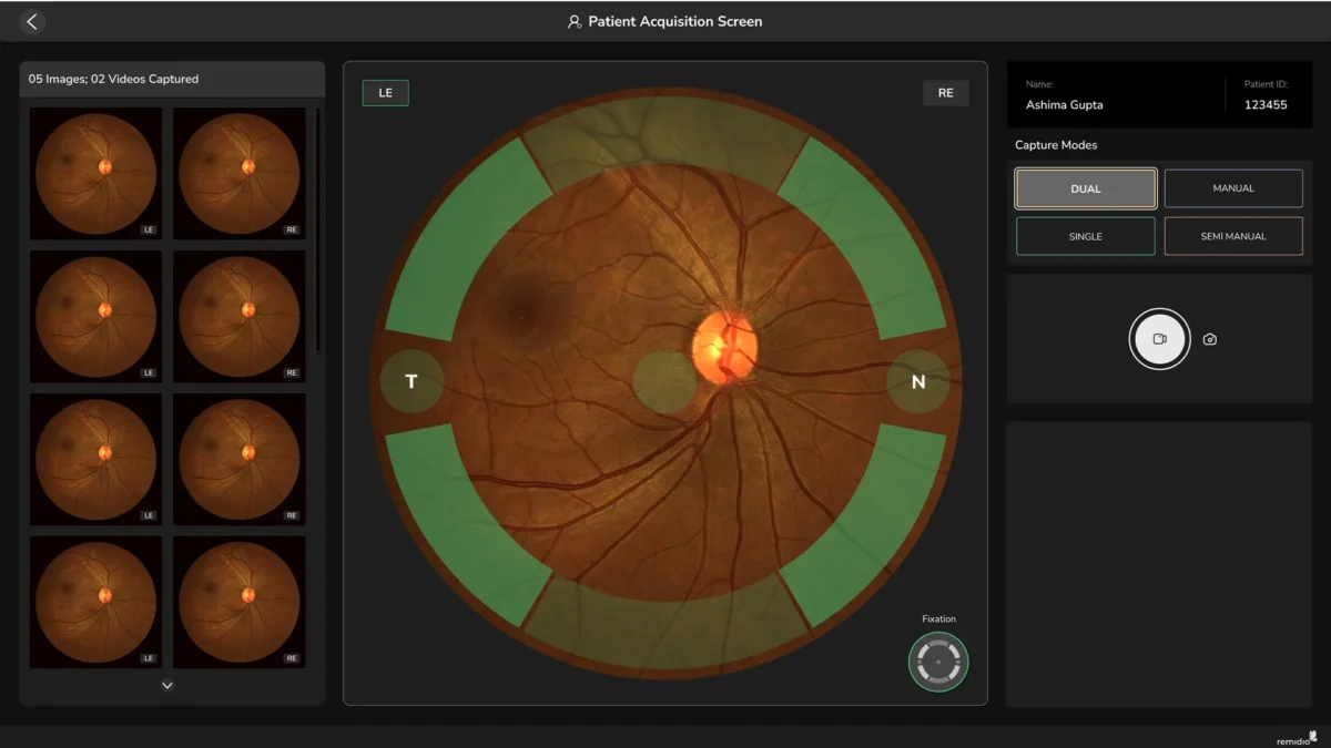 Laser-based autofocusing with AI pupil tracking